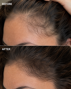Before-and-after hairline comparison for the Temple Bloom ritual.