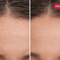 Her•Yang Radiance Renewal LED Mask for body contouring, featuring sleek design and adjustable straps.
