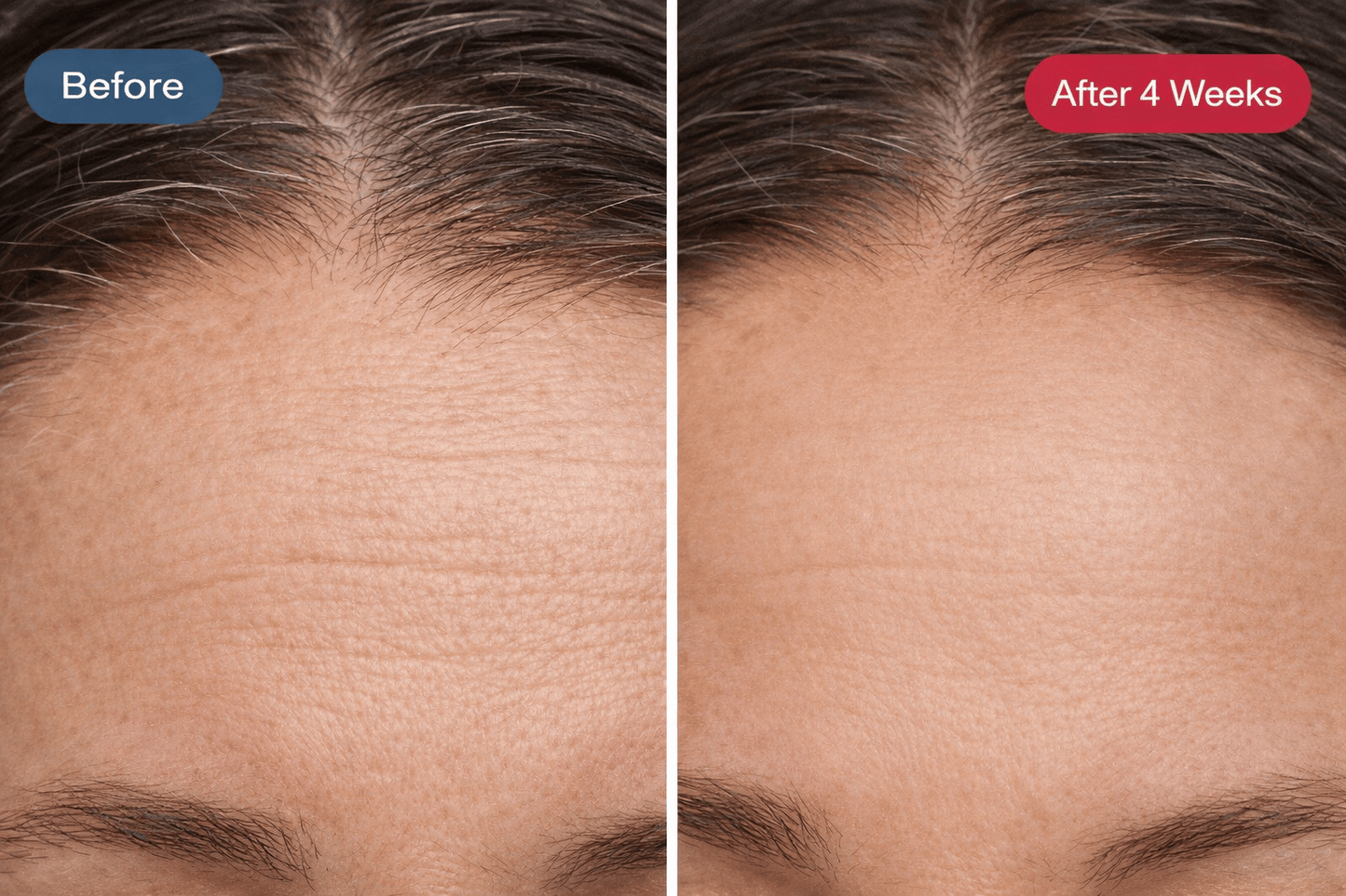 Her•Yang Radiance Renewal LED Mask for body contouring, featuring sleek design and adjustable straps.