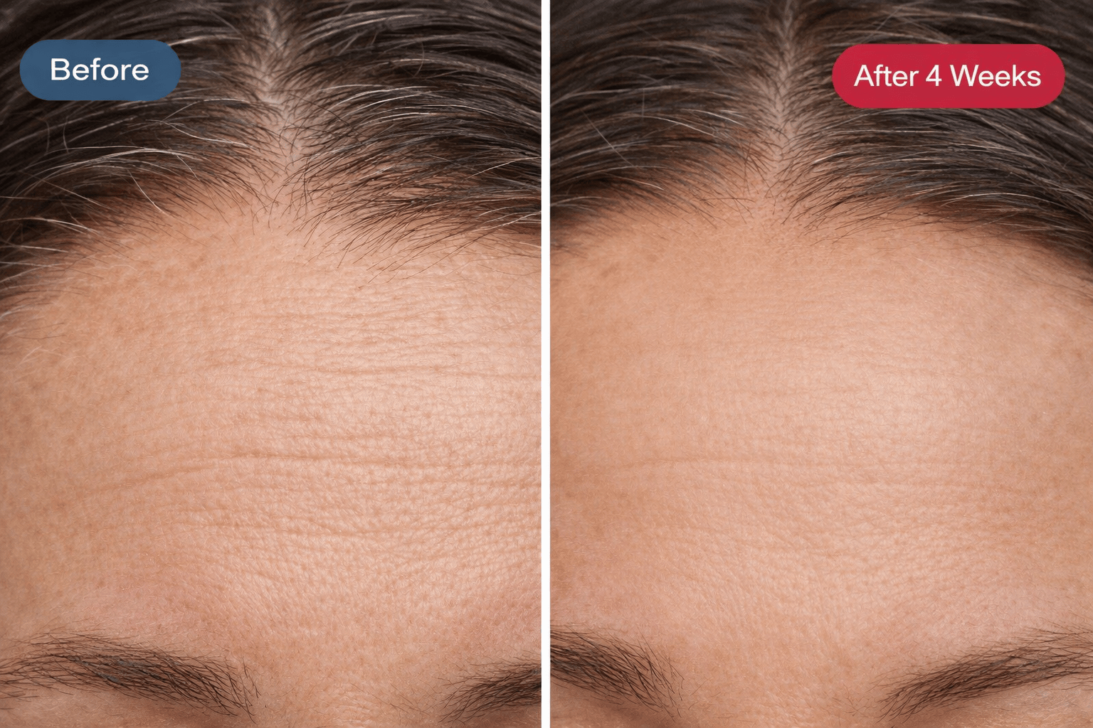 Her•Yang Radiance Renewal LED Mask for body contouring, featuring sleek design and adjustable straps.