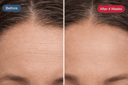 HerYang Radiance Renewal LED Mask showing a sleek facial mask with LED lights for skin rejuvenation and skincare tools.