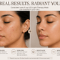 Her•Yang Radiance Renewal LED Mask for body contouring, featuring sleek design and adjustable fit on a model.