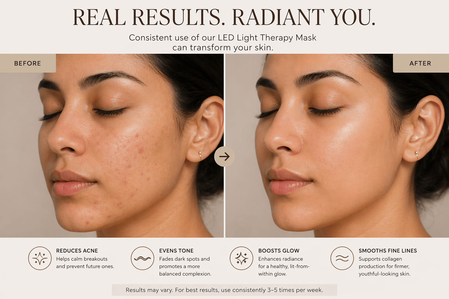 Her•Yang Radiance Renewal LED Mask for body contouring, featuring sleek design and adjustable fit on a model.